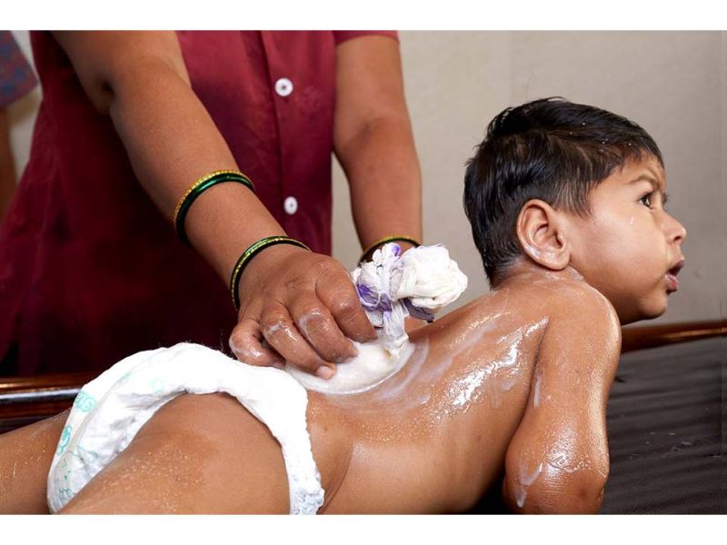 Panchakarma Therapy